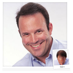 DermMatch Topical Shading