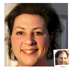 DermMatch Topical Shading